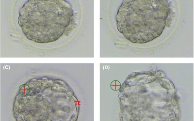 All About Thawing Frozen Embryos