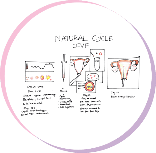 Natural cycle of ivf