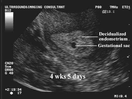 Confirming-Pregnancy