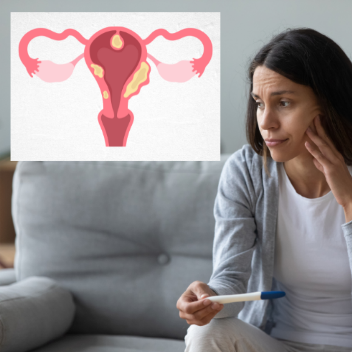 Uterine Fibroids & Infertility