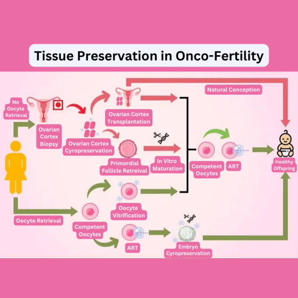 Tissue preservation in Onco-Fertility