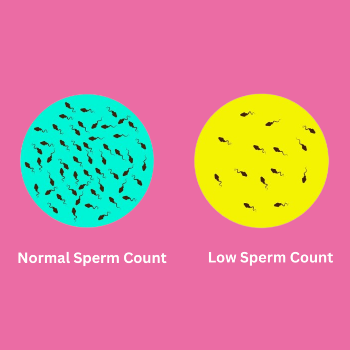 Low Sperm Count (Oligospermia)