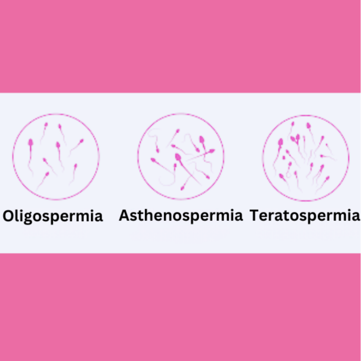 Oligoasthenoteratozoospermia