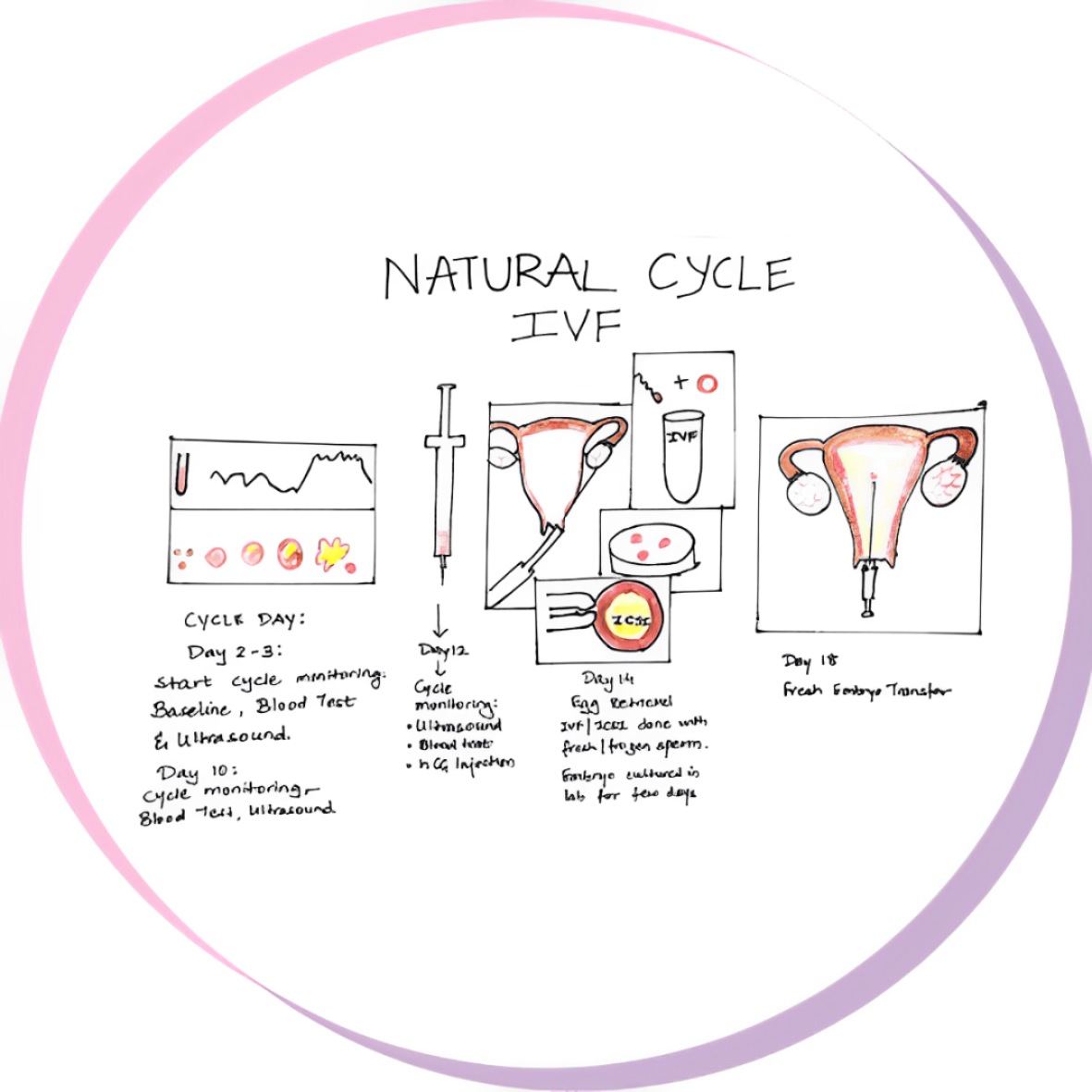 Natural Cycle of IVF