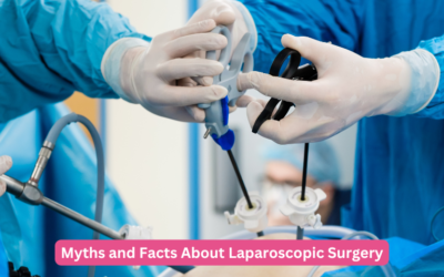 Myths and Facts About Laparoscopic Surgery