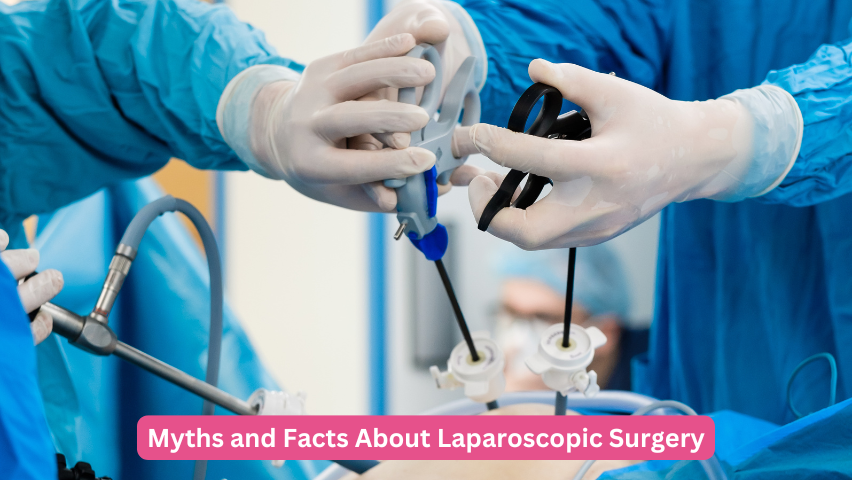 Myths and Facts About Laparoscopic Surgery