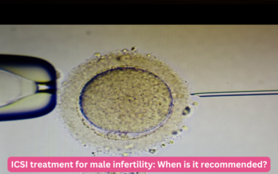 ICSI treatment for male infertility: When is it recommended?