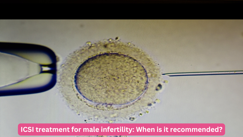 ICSI treatment for male infertility: When is it recommended?