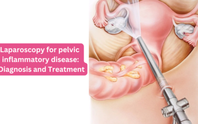 Laparoscopy for pelvic inflammatory disease: Diagnosis and Treatment