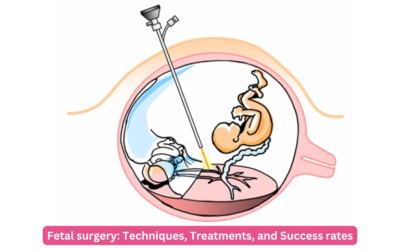 Fetal surgery: Techniques, Treatments, and Success rates