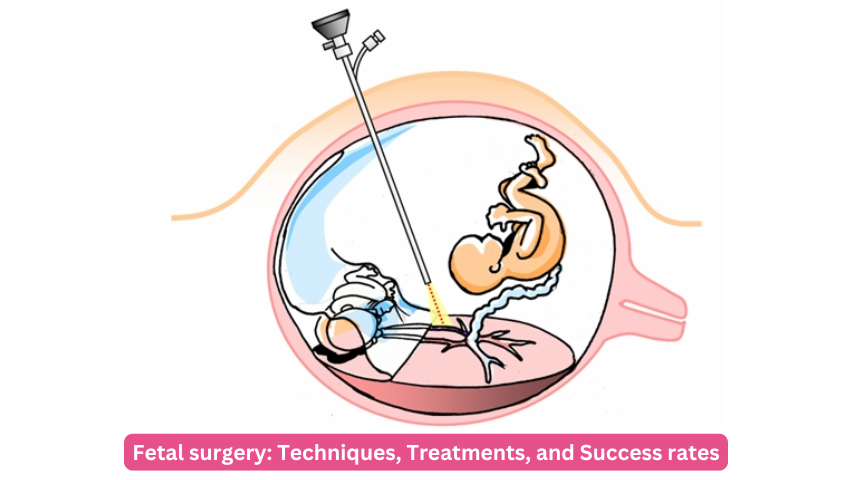 Fetal surgery: Techniques, Treatments, and Success rates