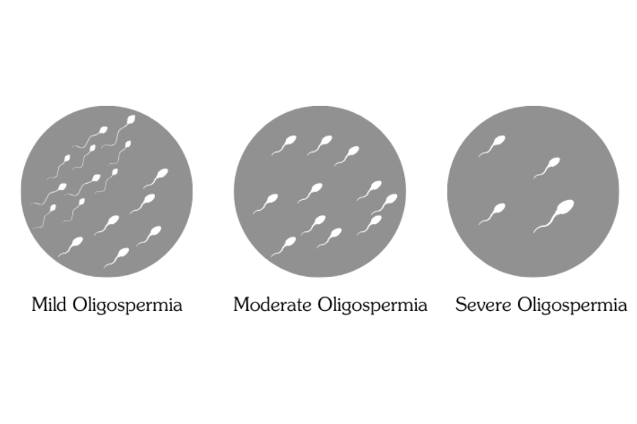 Types of Astheno-teratozoospermia