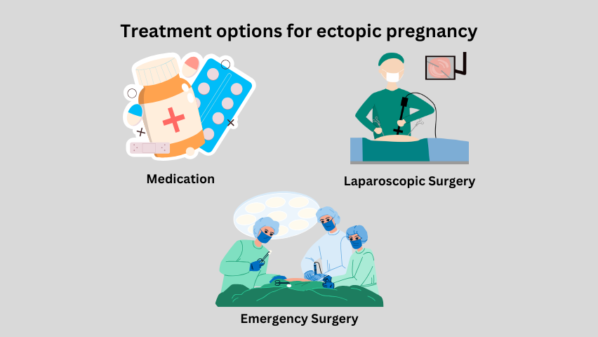 Treatment options for ectopic pregnancy<br />
