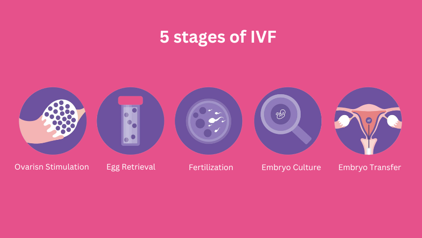 5 Stages of IVF