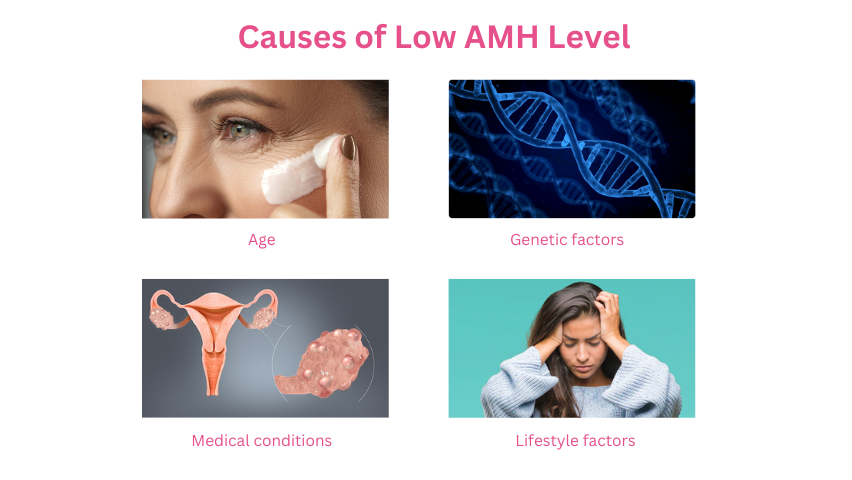 Causes of Low AMH Level