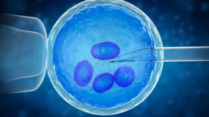 In Vitro Fertilization (IVF)