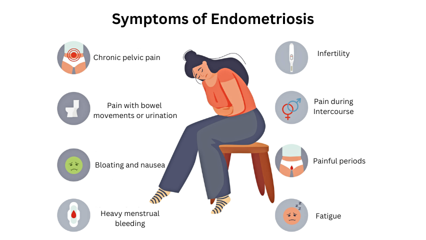 Symptoms of Endometriosis