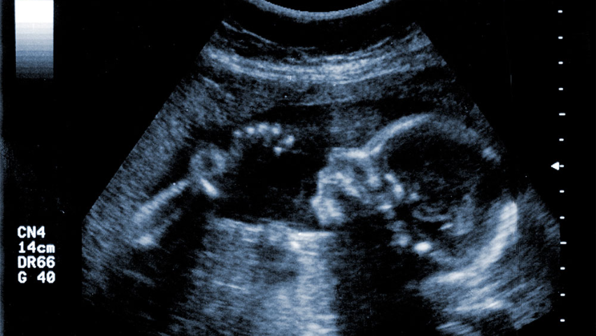 Ultrasound scans