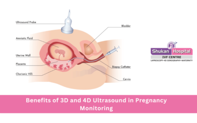 The Role of Amniocentesis and CVS in Pregnancy